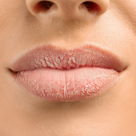 De ce arată rujul urât pe buze?
