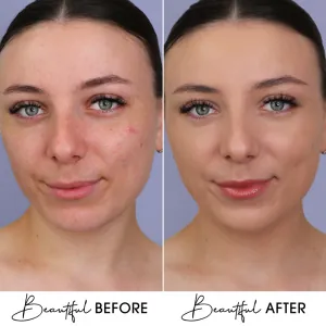 BB Cream Cu Extract de Melc & Aur Boys`n Berries Skin Filter SPF50 Natural Beige