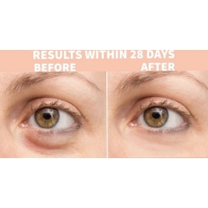 Ser Anti-Cearcane Nature Spell Watermelon Under Eye Serum