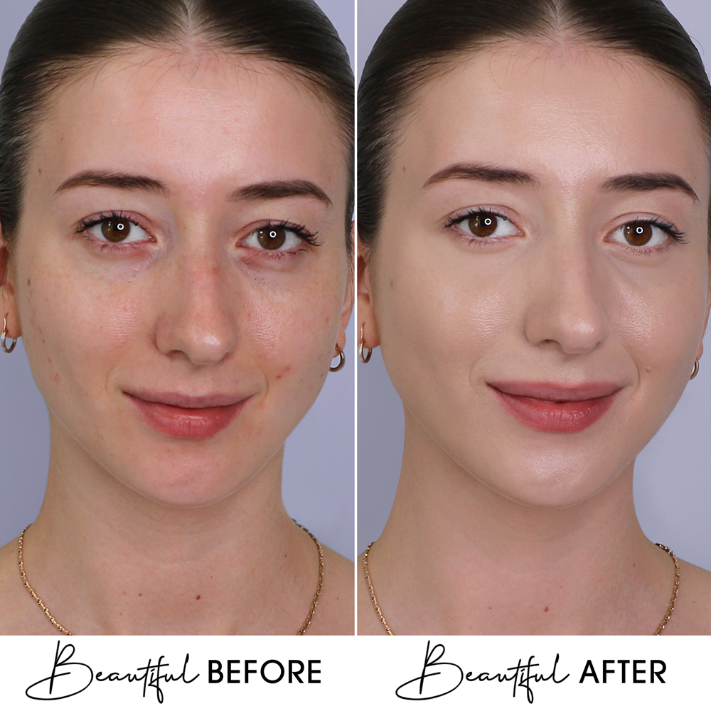 BB Cream Cu Extract de Melc & Aur Boys`n Berries Skin Filter SPF50 Light Beige