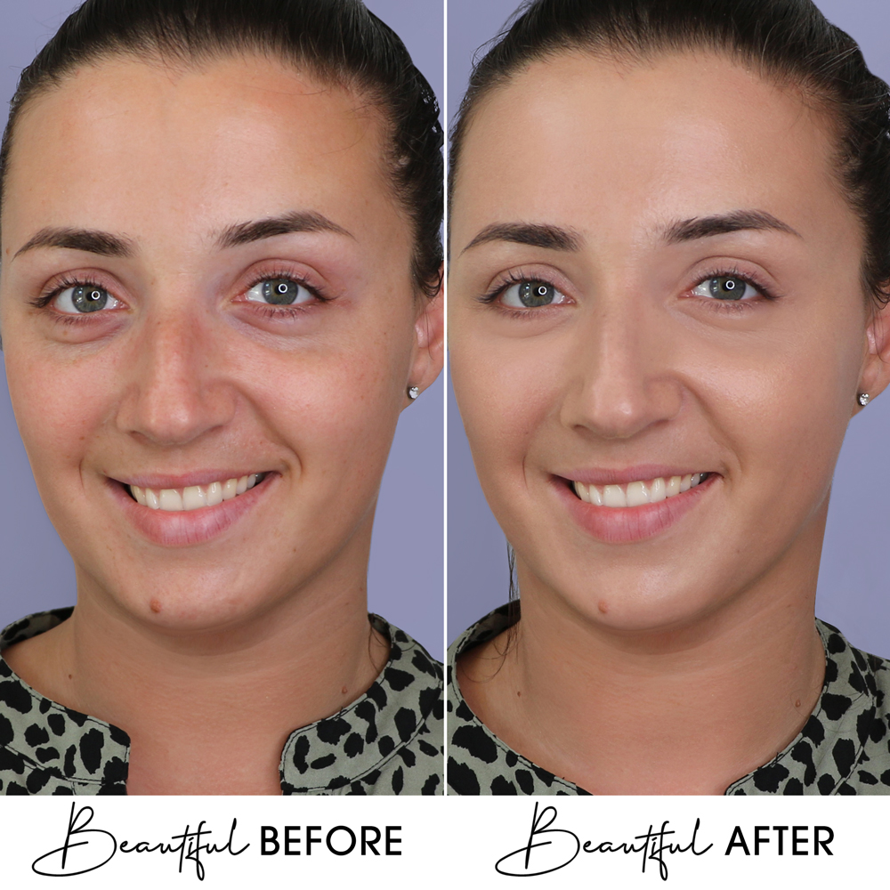 BB Cream Cu Extract de Melc & Aur Boys`n Berries Skin Filter SPF50 Natural Beige