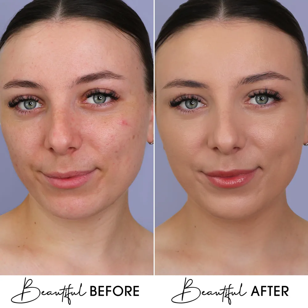 BB Cream Cu Extract de Melc & Aur Boys`n Berries Skin Filter SPF50 Natural Beige