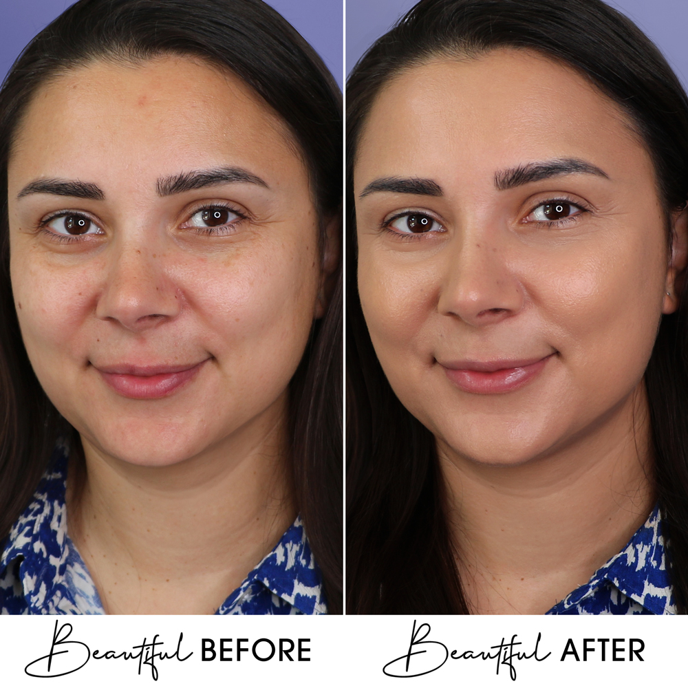 BB Cream Cu Extract de Melc & Aur Boys`n Berries Skin Filter SPF50 Warm Beige