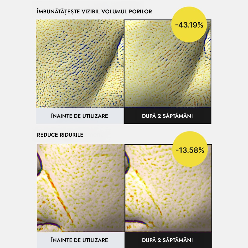 Ser concentrat Celimax Retinol Shot Thightening serum Anti-Aging