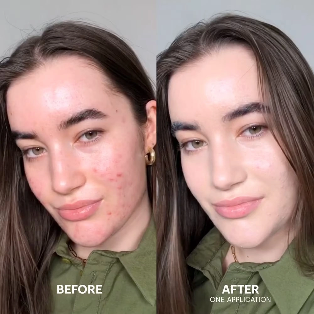 Crema Corectoare Dr. Jart Cicapair Tiger Grass Color Correcting Treatment