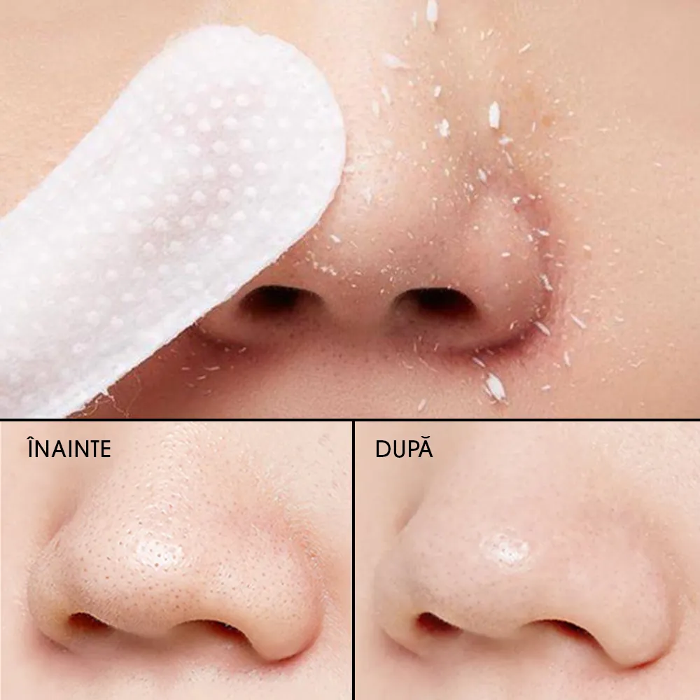 Dischete Exfoliante A`pieu Goblin Blackhead Peeling Pads
