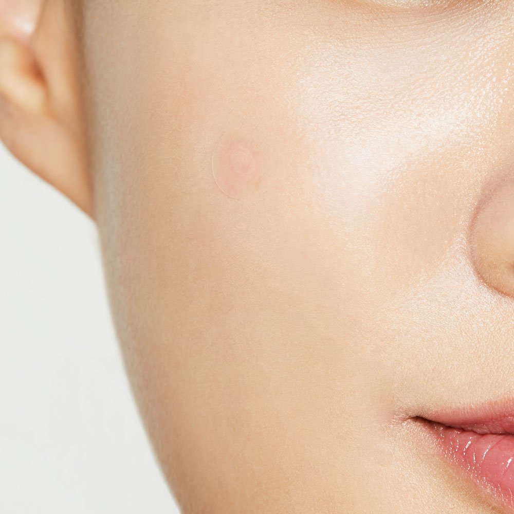 Plasturi pentru Tratarea Imperfectiunilor COSRX Clear Fit Master Patch (Somadermspot-S)