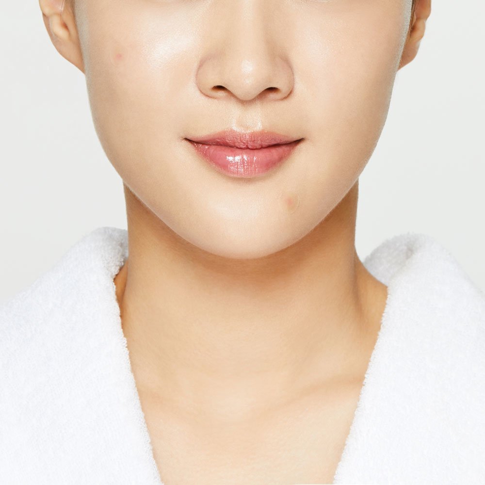 Plasturi pentru Tratarea Imperfectiunilor COSRX Clear Fit Master Patch (Somadermspot-S)